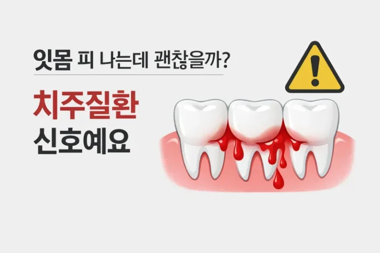 잇몸 피 나는데 괜찮을까? 치주질환 신호예요