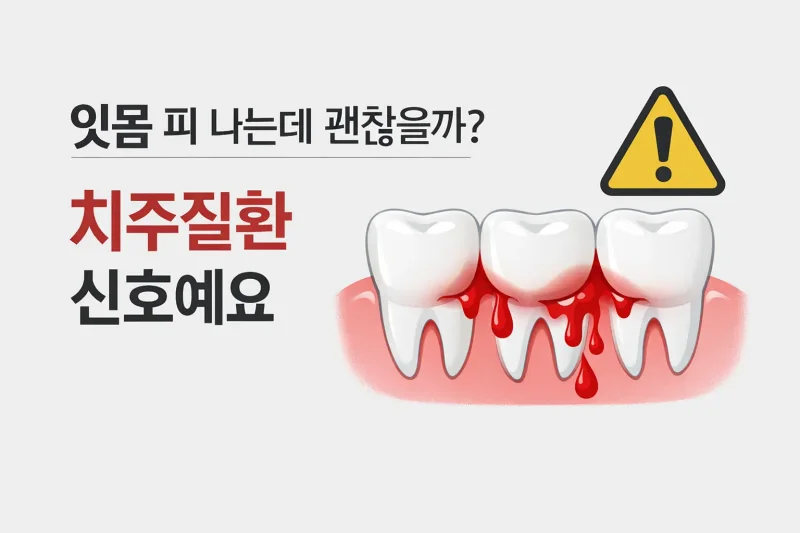 잇몸 피 나는데 괜찮을까? 치주질환 신호예요